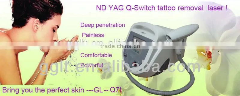 nd yag laser tatoo removal