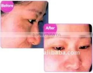 Portable e-light skin rejuvenation and hair removal beauty machine
