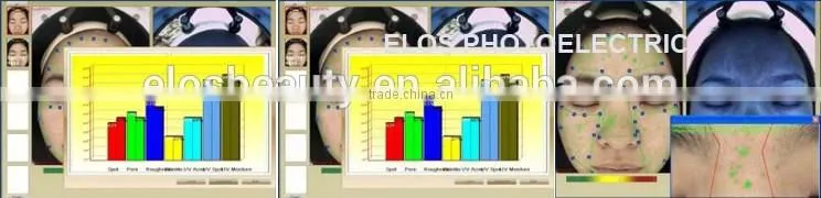 Professional Facial Skin Scanner Analyzer