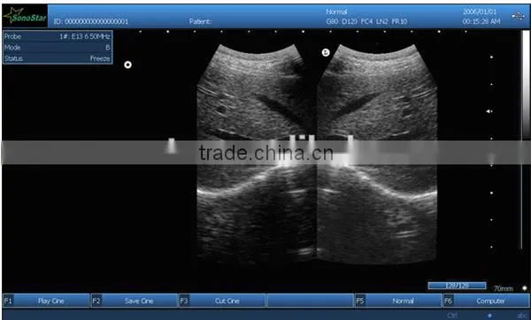 Sonostar good quality handheld portable vet ultrasound scanner pig veterinary ultrasound V10(SS-10V )