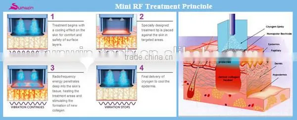 (SW-202B)Best Sell!! portable RF microcurrent face lift machine