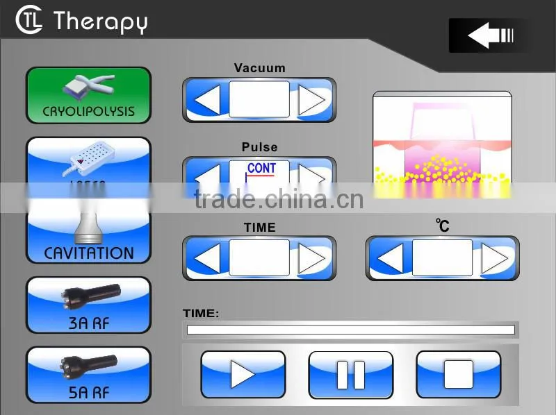 Satisfactory effect from customer feedbacks,Multifunctional vacuum lipo laser cryolipolysis rf cavitation 5 in 1