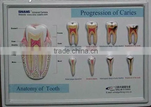3D embpssed poster