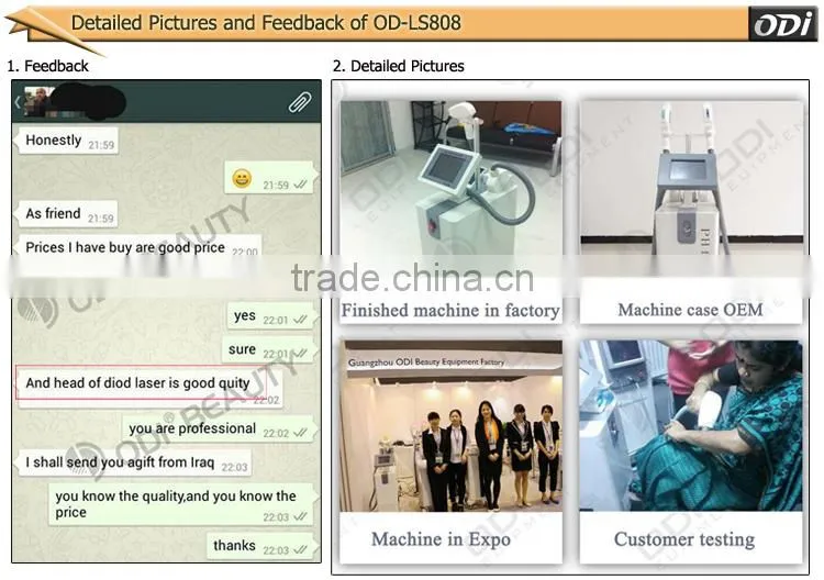 Bestselling cheap laser hair remover diode laser system OD-LS808