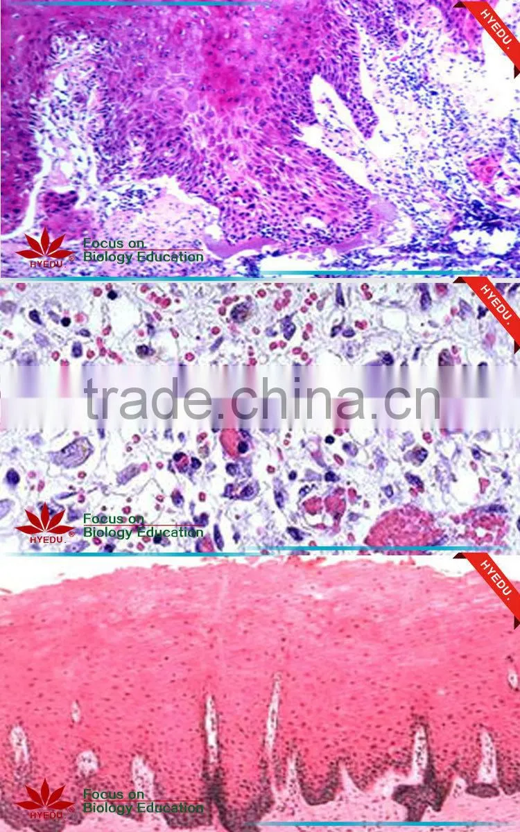 Human oral pathology slides Individual microscope prepared slide