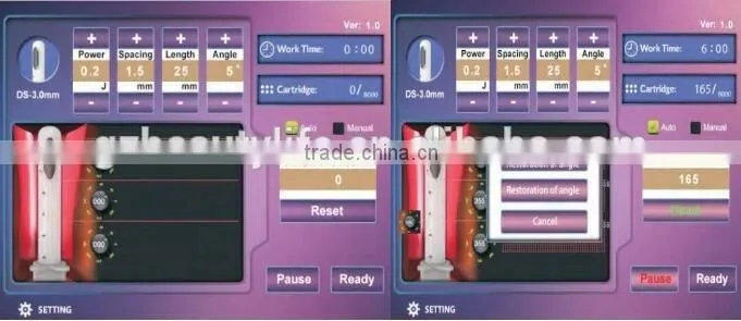 CE approved vaginal tightening hifu machine good result hifu therapy