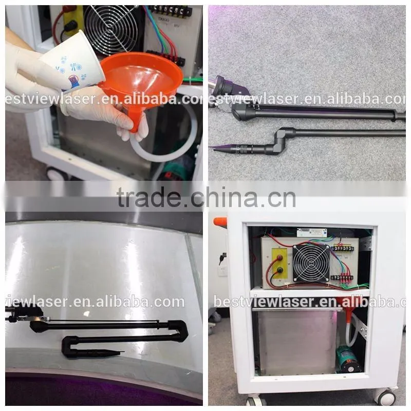 Fashionable updated beauty nd yag machine for tattoo laser /scar removal