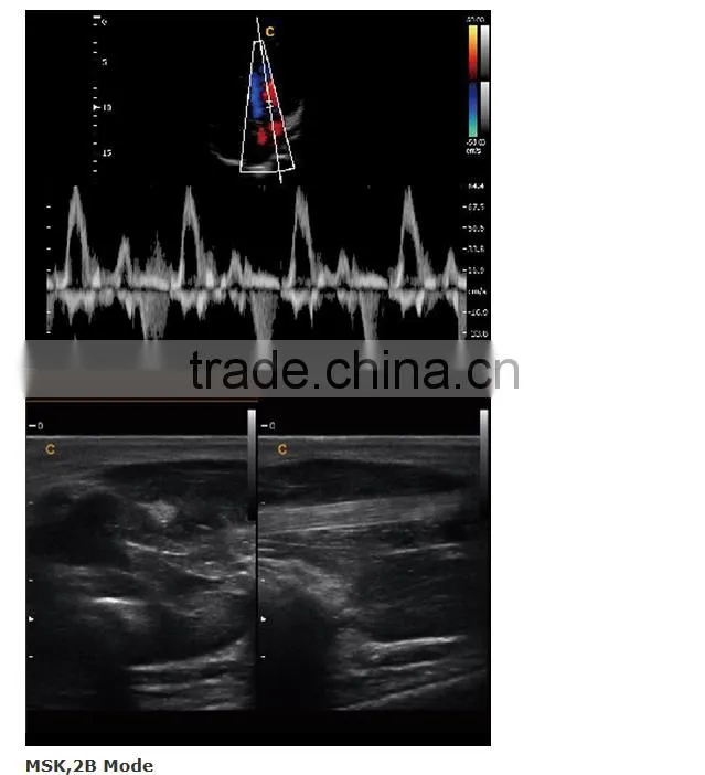 2016 new Portable Color Doppler(Optional 4D) for cardiac use