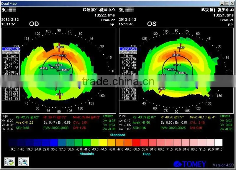 MCT Hard lens For low myopia/MCT lenses/no operation treat myopia,make your eyes normal