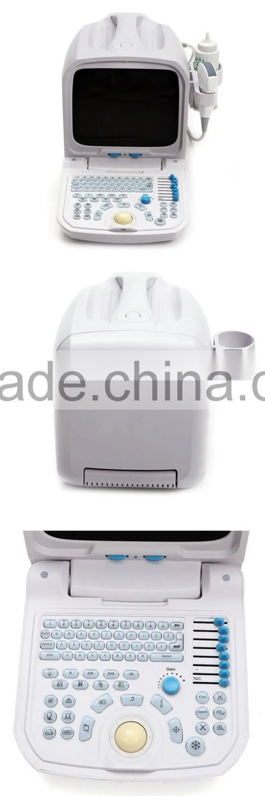 3D Portable Veterinary ultrasound machine
