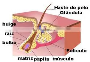 IPL OPT Permanent Hair Removal Ipl