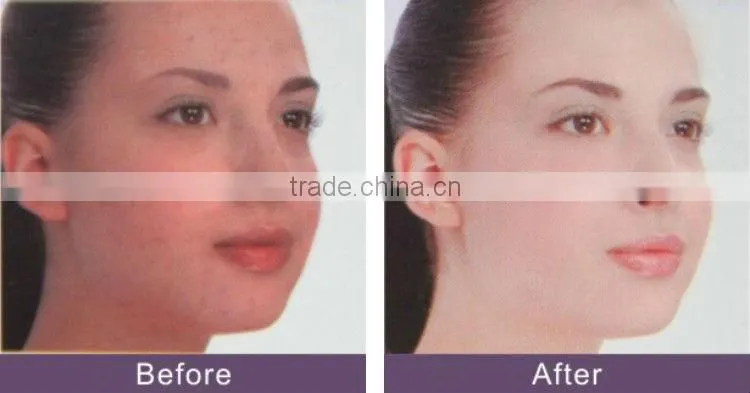 led facial mask for skin rejuvenation