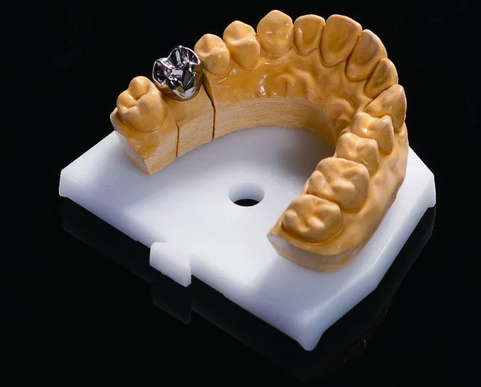 Welcome to Myy Dental Lab – Your Trusted Partner for Malo Bridge Solutions