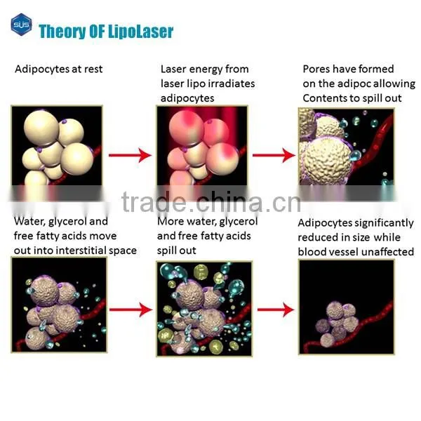 Reducing Belly Fat Ultrasound Slimming Machine Lipolaser Slimming Machine Laser Slimming Machine