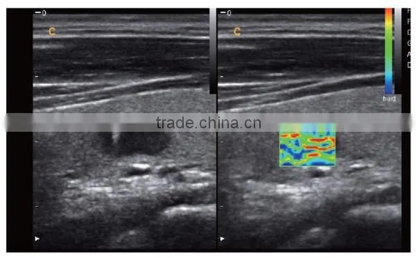 CE ISO approved medical 15 inch LCD Monitor 3D 4D trolley color doppler ultrasound scanner