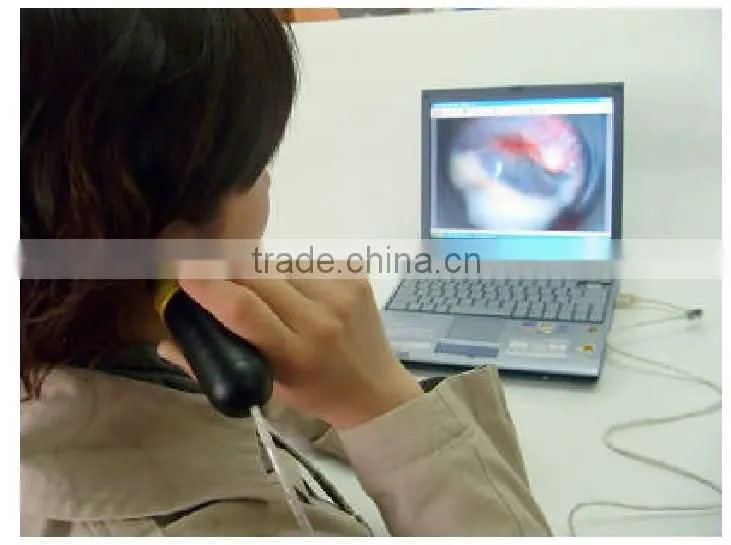 ear inspection camera USB/ear video camera/medical endoscope camera/medical endoscope usb camera