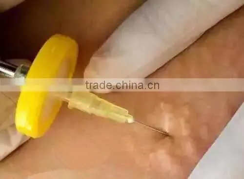 carboxy therapy equipment /carboxy therapy machine