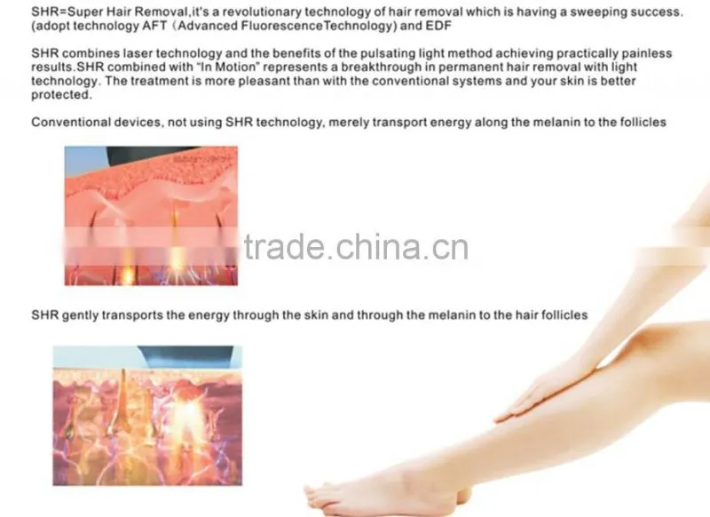 ipl shr machine / shr ipl hair removal machine pain free