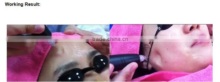 NL-SPA10 2016 Water spray +oxygen jet dermabrasion +skin scrubber facial spa equipment for sale