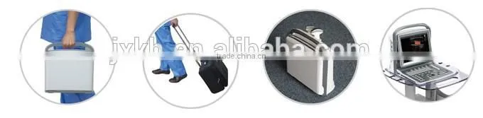 2016 NEW ultrasound scanner Color doppler