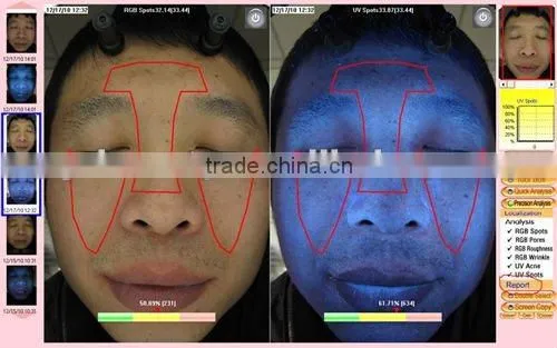 WT-01-S Magic Mirror skin analyzing machine