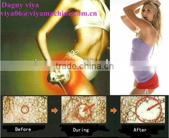 VY-M4 2014 Fat loss RF beauty machine keyword cavitation slimming machine