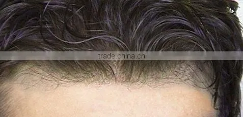 mens hair piece