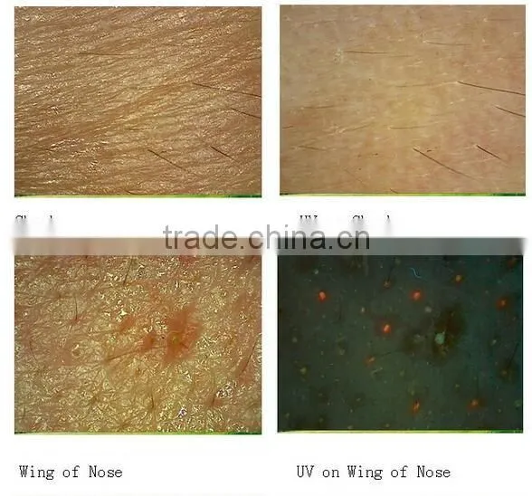 AYJ-J016 skin ance blackhead wrinkle microscope