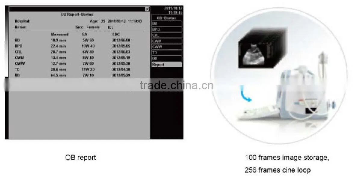 FN260V Full digital B model vet ultrasound device
