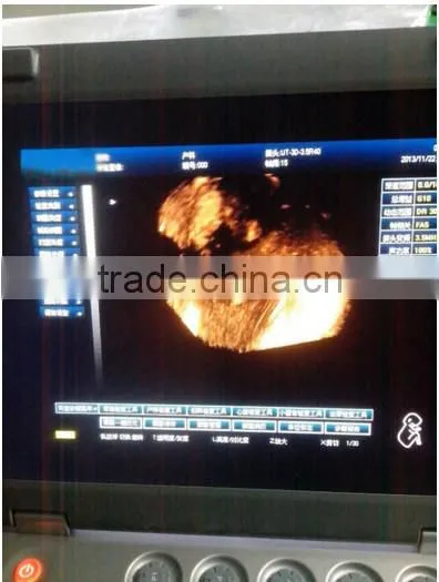 (MSLCU18)3D 4D handheld Color Doppler Medical Ultrasound Scan Machine
