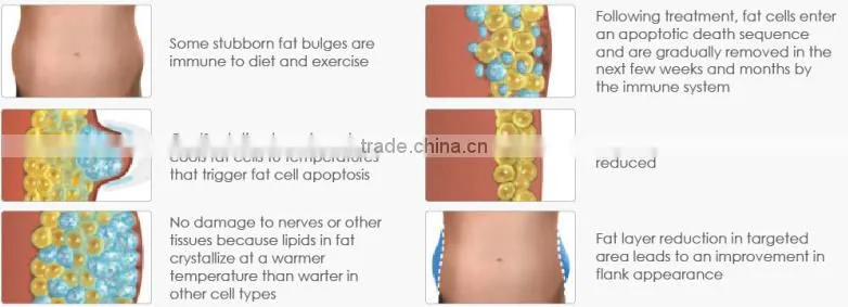 Trade assurance! 5 handles cryolypolisis freezing equipment cool shape fat freezing machine