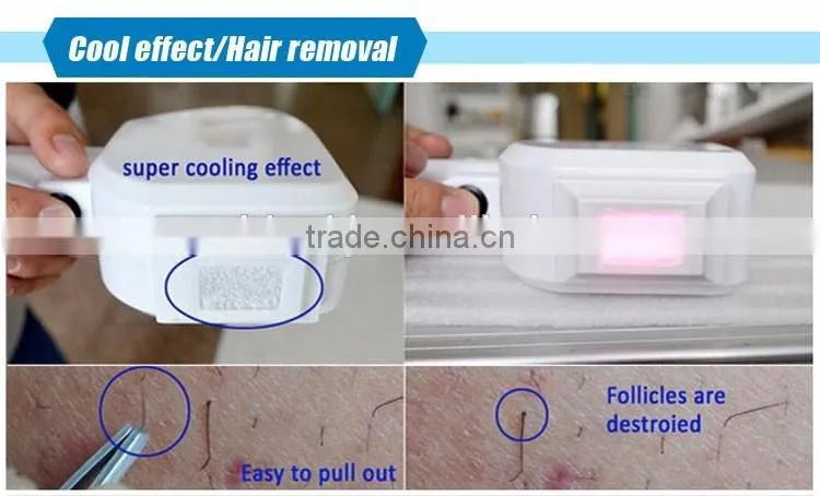 New type TEC condenser 808nm diode laser hair removal mini epilator