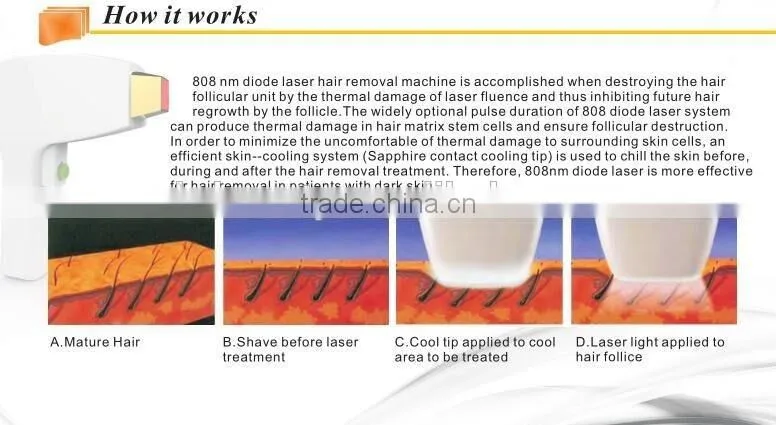 Super Cooling! 808 Diode Laser Cold Permanent Hair Removal / Diode Laser Hair Removal Machine