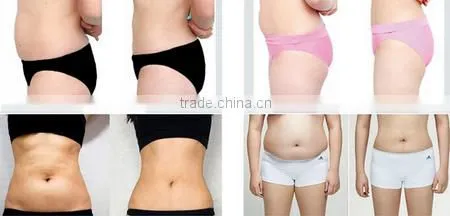 High Frequency Focused Ultrasound HIFU Slimming Machine