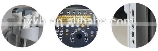 2016 NEW ultrasound scanner Color doppler