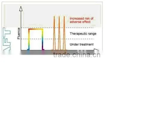 Alma laser technology SHR IPL fast hair removal from Vanoo