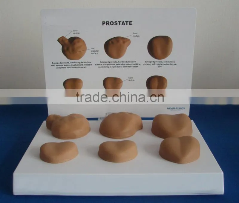 V-AM028 Wholesale human male anatomical prostate model