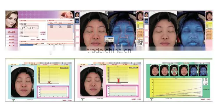 sa100 Latest excellent magic scoper magic mirror skin analysis