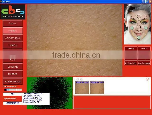 Promotion price !!!!! skin analysis system a-one