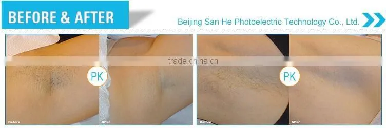 Beijing 950B Multifunction ipl rf e-light FDA approved beauty equipment