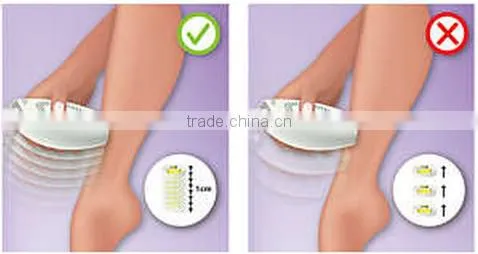 2016 Newest IPL Hair Removal Machine Prices / factory price ipl hand elight