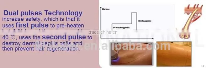 KLSi CE Approval Tech 808nm Diode Laser Hair Removal / 808nm Diode Laser/ Diode Laser Beauty Equipment