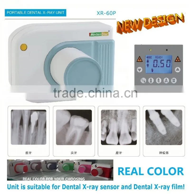 Portable dental products X-ray equipment XR-60P
