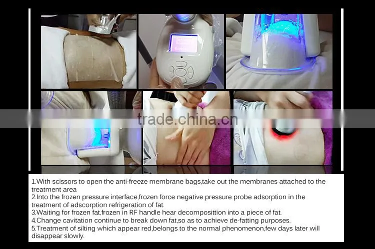 Big discount!!! Best seller freeze machine cryo freezing fat removal body slimming machine for salon use