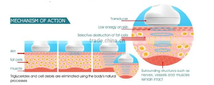sanhe hifu body shaping fat removal slimming machine/Hifu slimming