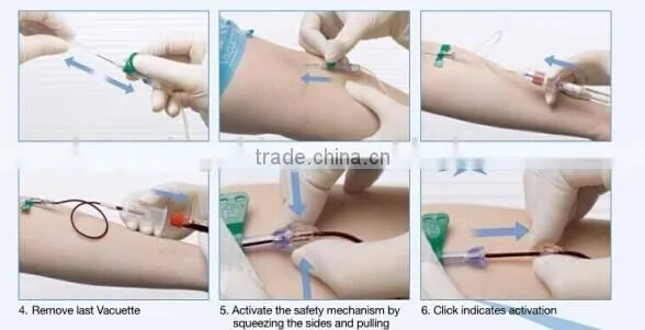 vacuum blood collection tube/glucose tube