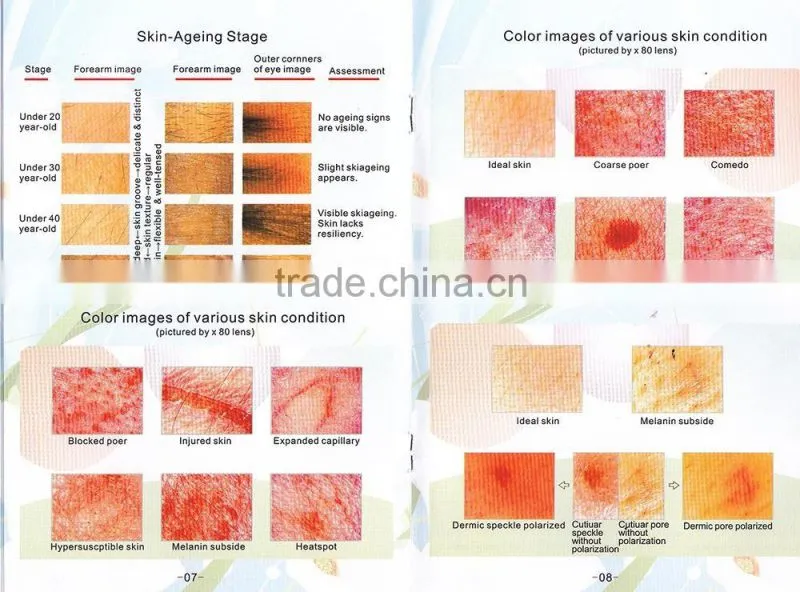 Medical Equipments Skin and Hair Analyser With CE Approved