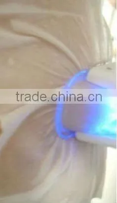 Antifreeze membrane for freezing lipofreeze machine