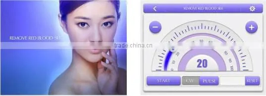 acne spider vein removal machine / high power spider vein removal machine / vascular vein spider vein removal rf