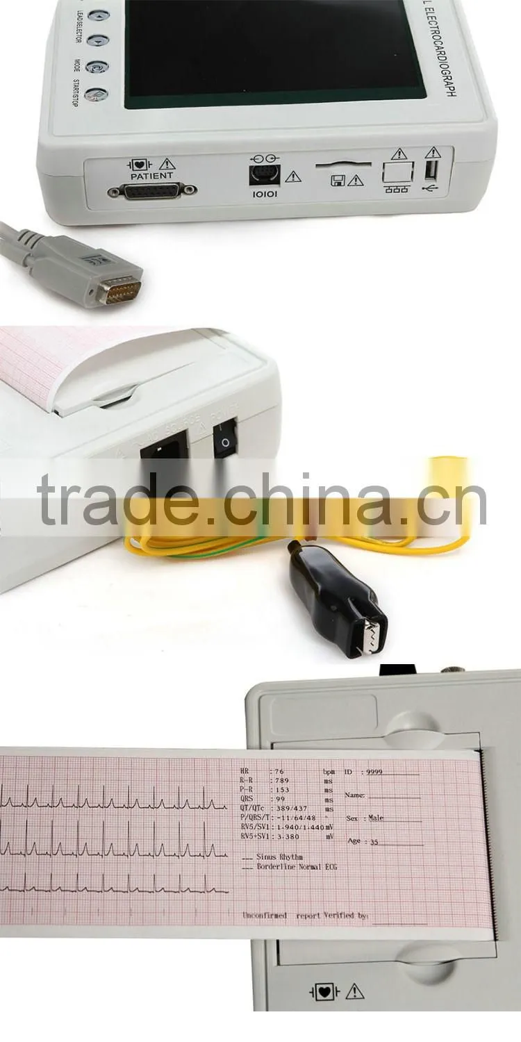 China supplier of portable electric three/six/twelve channels ecg machine electrocardiograph 3 channels